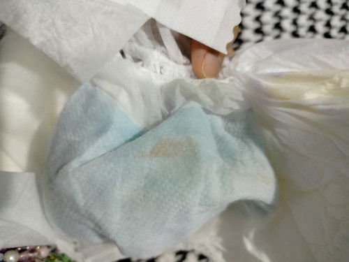 Tanda merah pada pampers