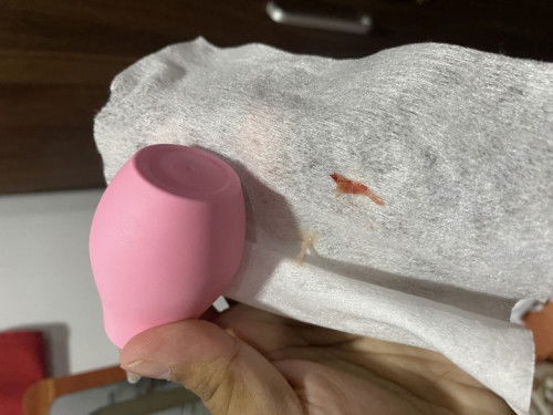 Sipon na may kasamang dugo