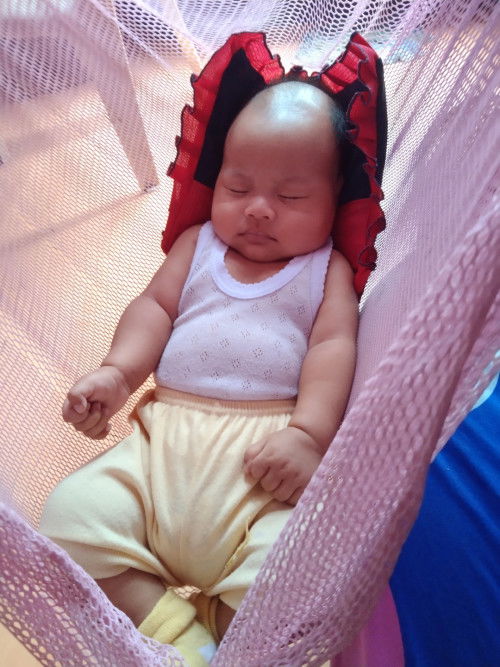 Kepala bayi lonjong