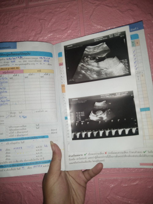 ช่วยดูให้หน่อยค่า