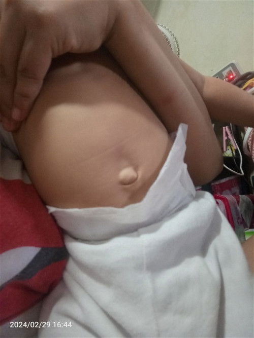 Hello po mga mie at kung may mga mommies na pedia o doctorna may alam sa ganito sa pusod ng baby ko