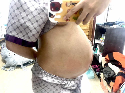 ท้องลดยังคะ 37+2