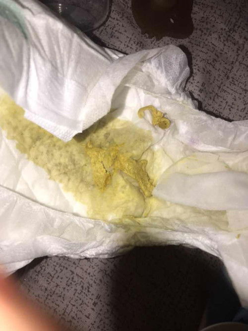 ลูกถ่ายแบบนี้ปกติไหมคะ