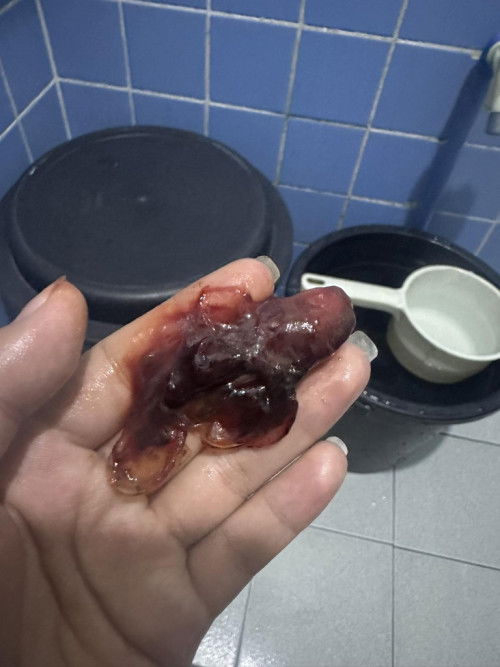 Norml lang po ba may lumabas na buong dugo like ma jelly sya pag naginsert ng primrose oil sa Gabi?