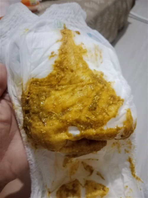 Bayi 4 bulan selalu bab sesaat setelah minum asi