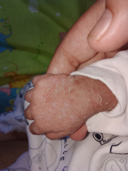 Tangan dan kaki bayi putih2