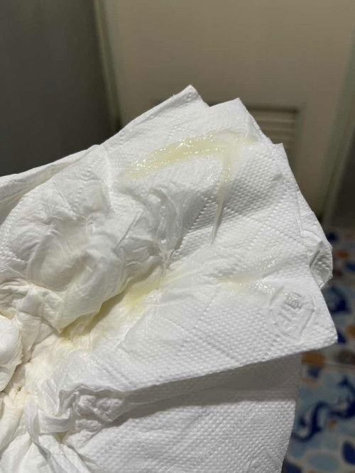 สอบถามค่ะ มูกหรือเมือกใช่ไหมคะ