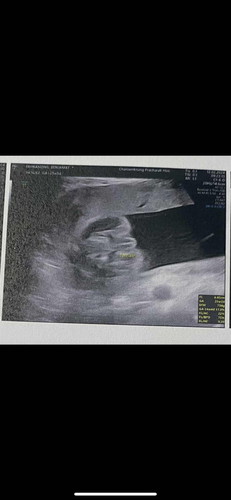 ช่วยดูให้หน่อยค่ะ