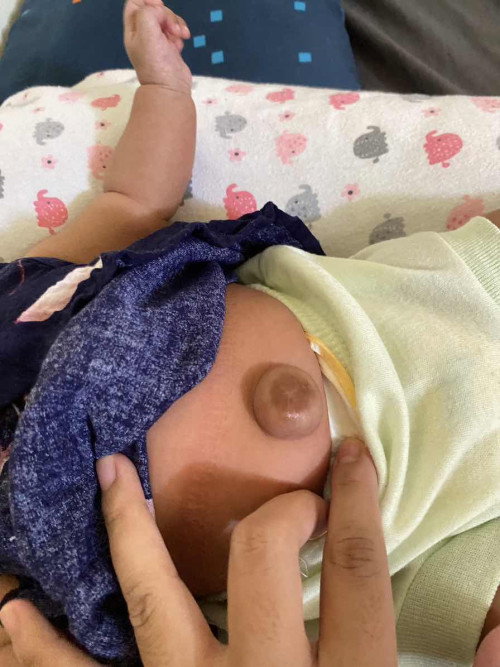 Udel bayi nongol