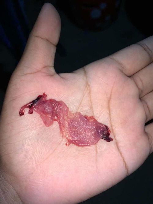 แม่ๆค่ะแบบบนี้คืออะไรค่ะ ใครรู้ช่วยบอกที่ค่ะ