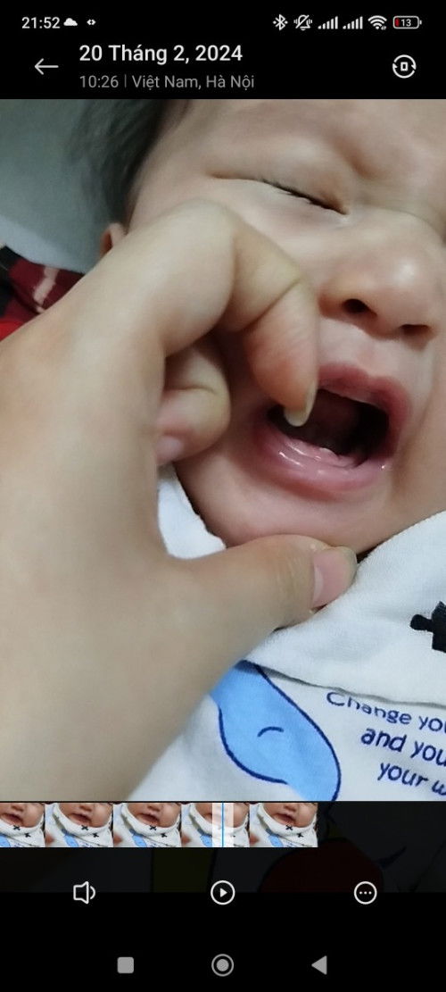 Nanh sữa hay răng sữa ạ?