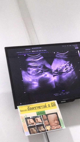 แม่ๆช่วยดูเพศให้หน่อยได้มั้ยคะ