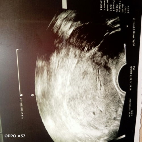 Mohon tanggapan nya bun🙏