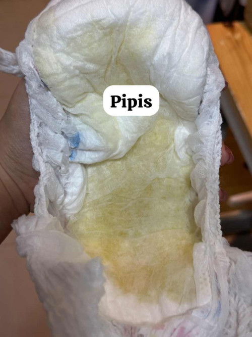 Apakah bayi kurang minum atau pengaruh dari sufor