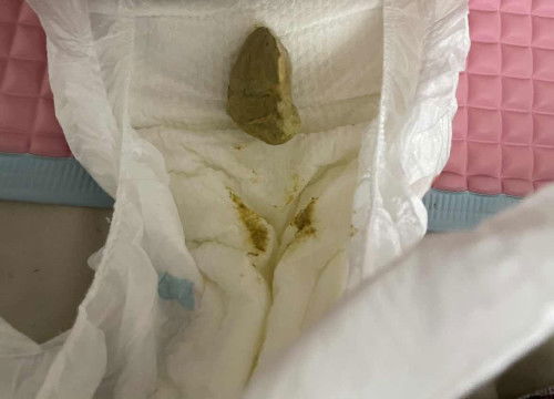 Najis baby 3 bulan hijau.