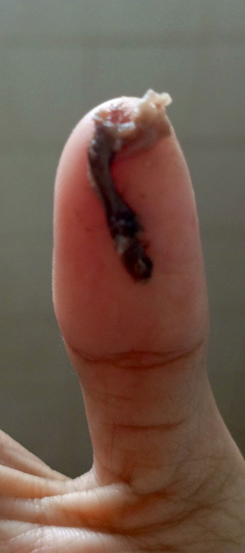 Keluar flek coklat siang ini