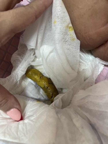 baby's poop