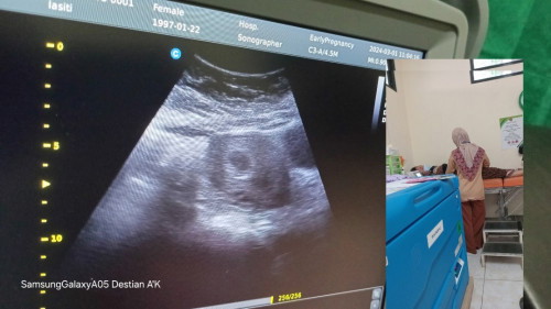 Apa wjr dok hamil 4 minggu seperti itu