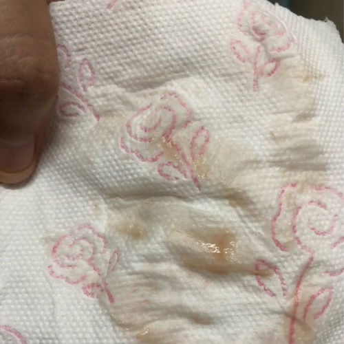 ท้อง 10w 2d ท้อง2