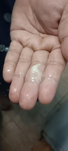 รบกวนสอบถามแม่ๆหน่อยค่ะ แบบนี้เรียกมูกขาว หรือตกขาวค่ะ 39w1d ไม่มีอาการปวดท้องอะไรเลย