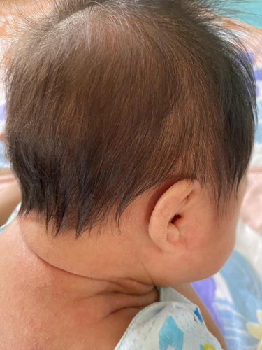ลูกเป็นแบบนี้ทำไงจะหาย