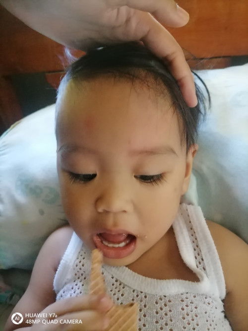 Nag ka bukol dahil nahulog sa upuan