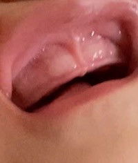 Teething 7 months old