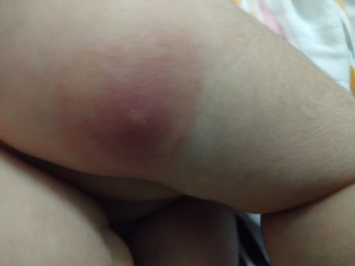 Nk tanya ad tak baby yg lepas cucuk kat bahu jd mcm anak saya