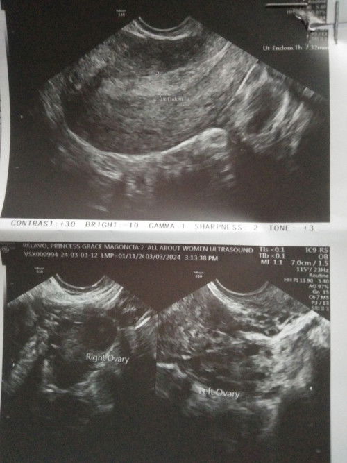 Sino nka ranas po na 1month palang di Makita sa tvs ung baby