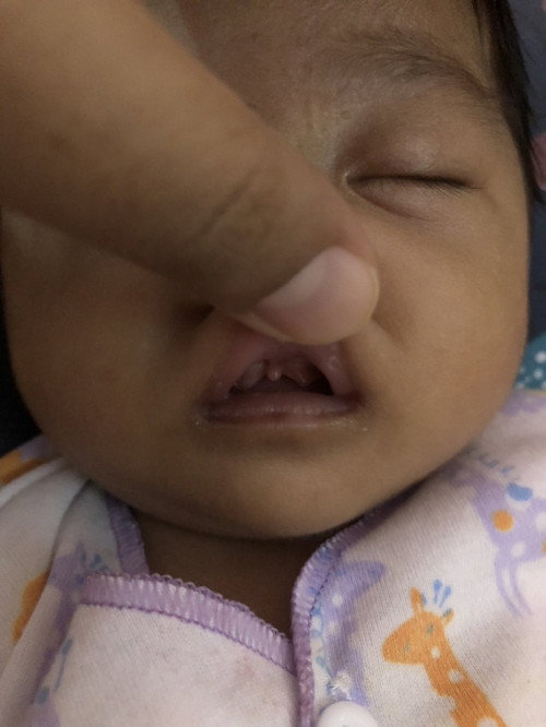 Gusi bayi newborn