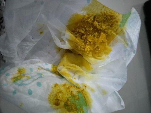 Pup bayi newborn  seperti ini normal nggak ya bun? Minumnya asi sama sufor sehari juga pup bbrp kali