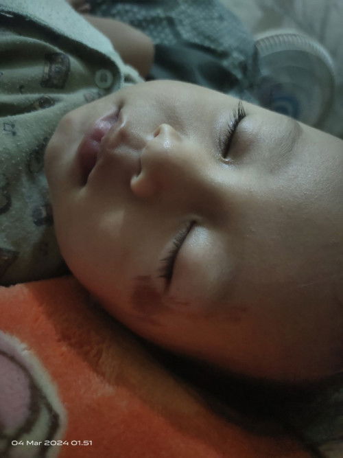 Luka tergores batu koral