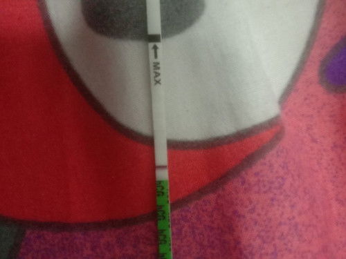 ฝังเข็มแบบ3ปี