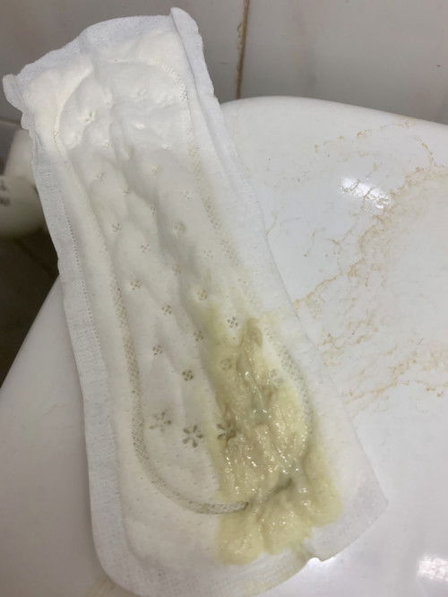 Em đang bầu tuần 32