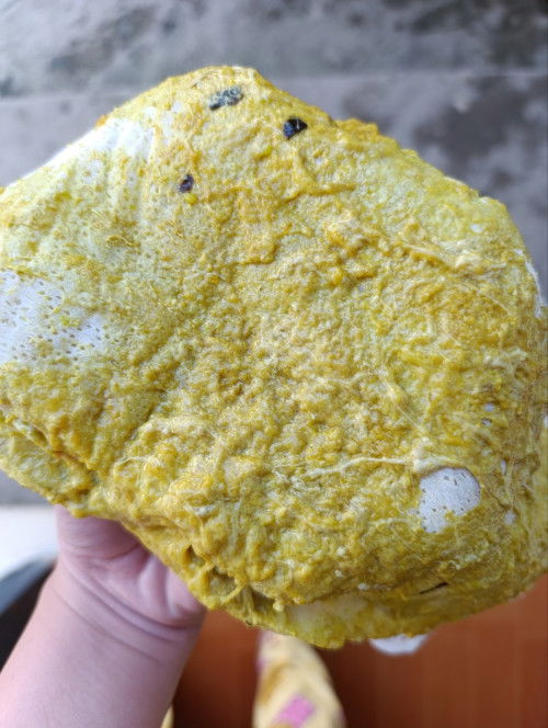 17months baby may amoeba