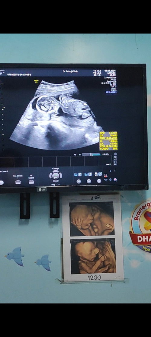 บ้านไหนรู้เพศแล้วบ้าง