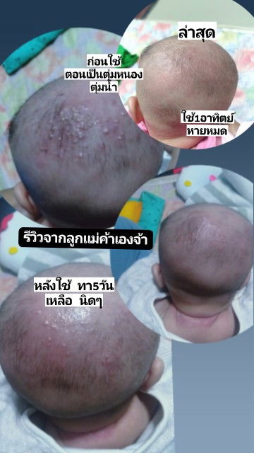 ลูกบ้านไหนเป็นบ้างค่ะแม่มียาทามาแนะนำค่ะ