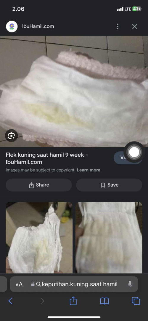 Flek atau keputihan ya?