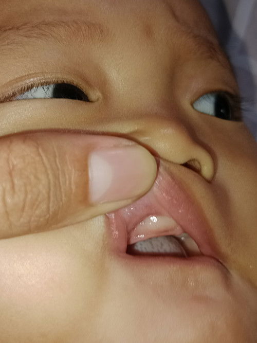 bayi 8 bulan tumgi atas dulluan