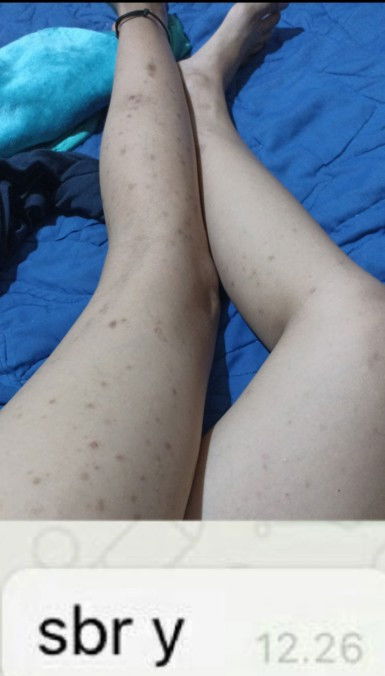 #info obat penghilang bintik2hitam