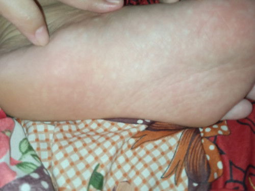 Usia kandungan masuk 31 minggu