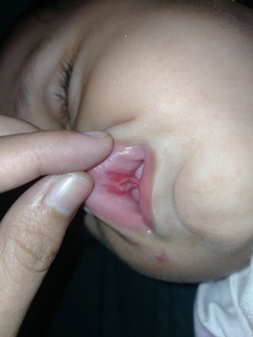 Bantu jawab bun