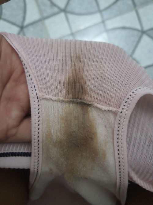 สงสัย กังวน ขณะตั้งครรภ์