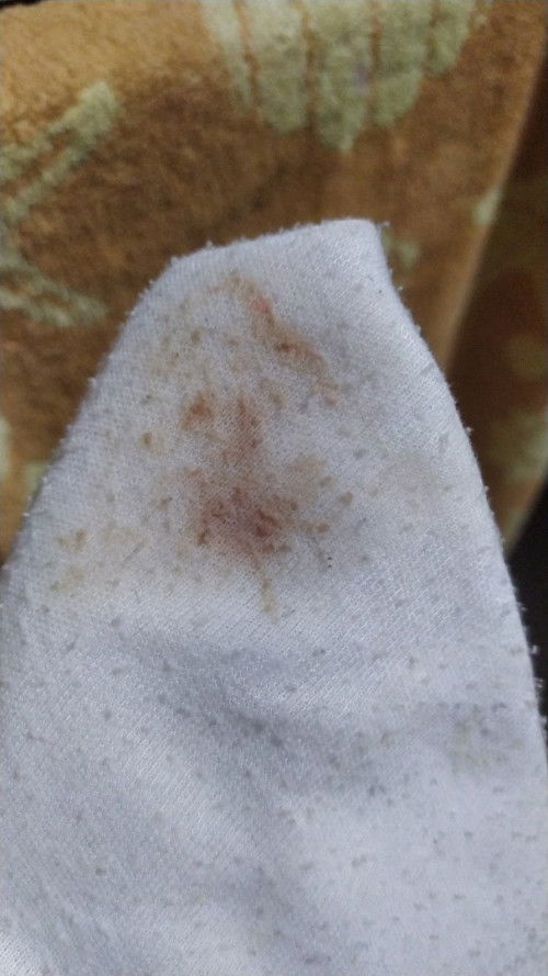 Keputihan merah muda