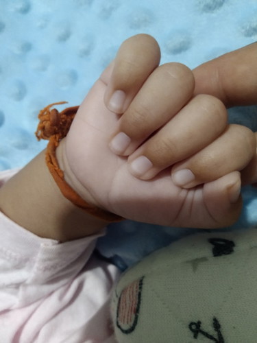 ลูกเป็นดอกเล็บสีขาว