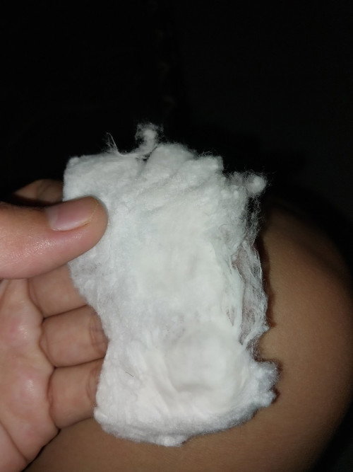 Tm 3 ,Keputihan gatal