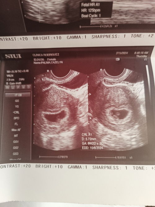 Kailangan po bang magbedrest dahil sa 35yrs old na ako at 1st baby ko po ito,