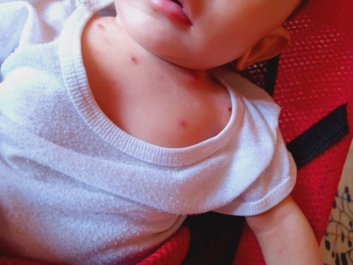 baby care