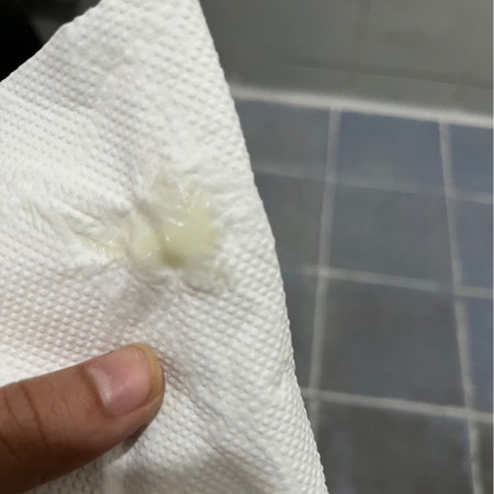 แม่ๆๆตกขาวแบบบนี้อันตรายไมคะ