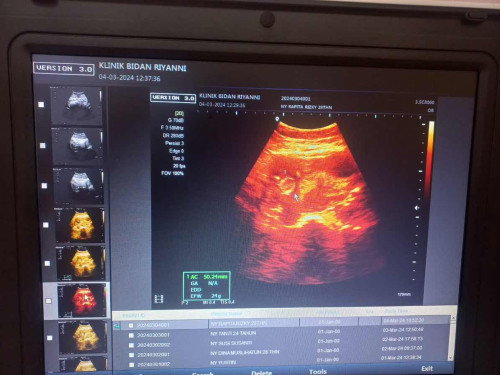 Janin 12minggu aktif bngt ada yg sama?